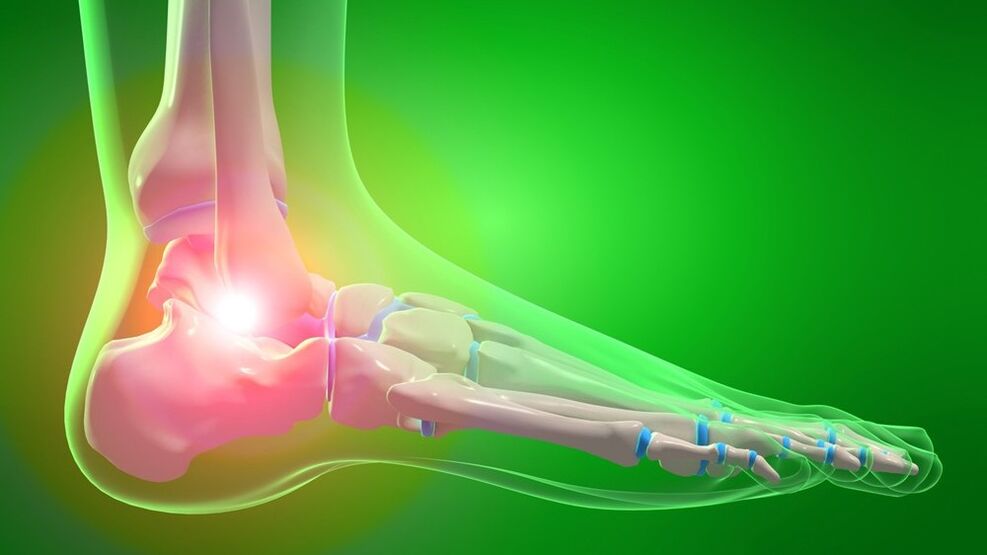artrose da articulação do tornozelo