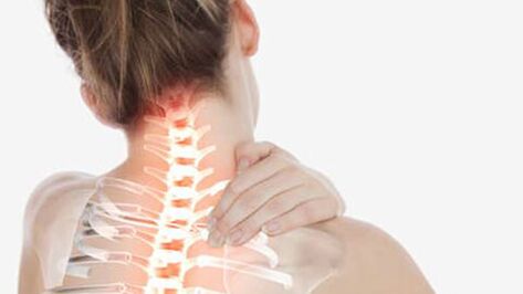 Osteocondrose da coluna cervical