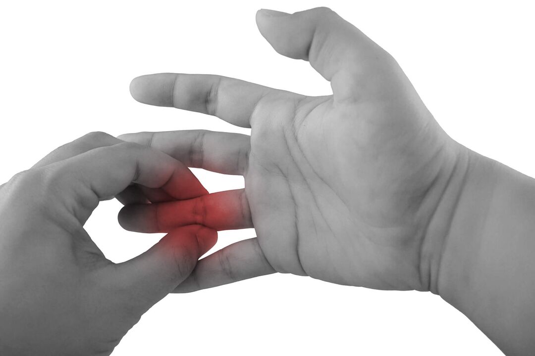 inflamação nas articulações dos dedos como causa da dor