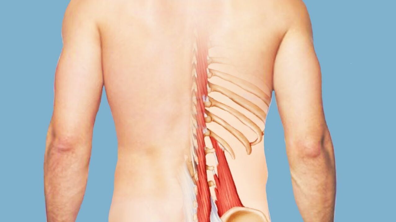miosite como causa de dor nas costas